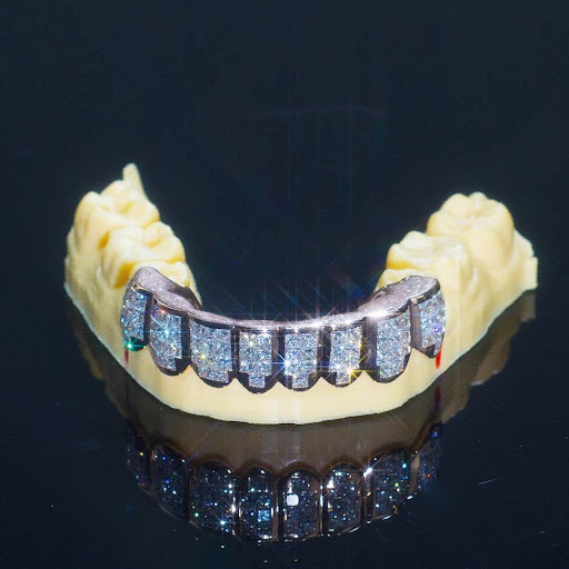 Moissanite Grillz: The Future Of High-End Custom Jewelry For Your Smile